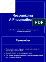 Recognizing Pneumothorax