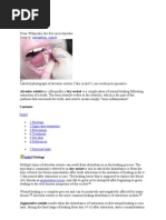 Download Dry Socket Drg by Diza Lf SN40908667 doc pdf