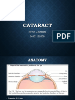 Cataract: Kevin Chikrista I4061172039