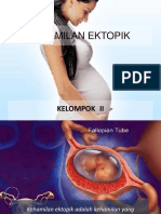 Kehamilan Ektopik Kel 2