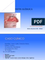 Rinitis Alergica Caso Clinico