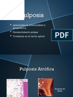 Endo - Pulposis