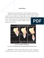 Avulsia Dentară: Figure 1.mecanismul Avulsiei Dentare