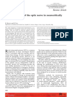 Ultrasonography of The Optic Nerve in Neurocritically Ill Patients Moretti2011