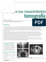 Verifique Sus Conocimientos Sobre Tomografía