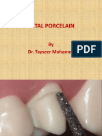 Dental Porcelain: by Dr. Tayseer Mohamed