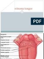 Carcinoma Tongue