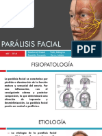 Parálisis Facial