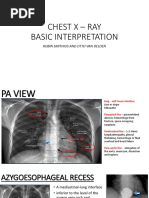 Chest X-Ray Interpretation Guide | PDF | Lung | Thorax