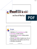 Normal EEG in adults