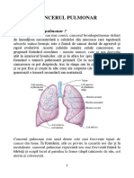 cancerul pulmonar.pdf