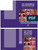 Cover Gigi Tiruan Implan Dan Overdenture - 2 Cover Pilihan PDF