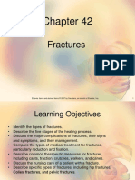 Fractures