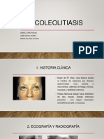 Wiki 6 Coleolitiasis