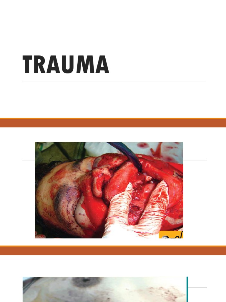 Traumareport | PDF | Major Trauma | Traumatology