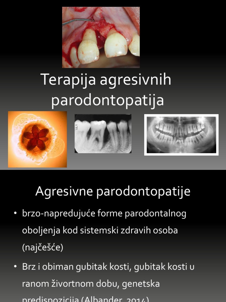 Agresivne Paro TH | PDF