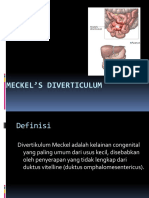 125305188-Meckel-s-Diverticulum.ppt