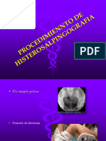 Proc de Histerosalpingografia