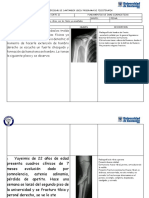 Taller Segundo Corte Fracturas