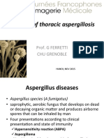 Imaging of Thoracic Aspergillosis: Prof. G Ferretti Chu Grenoble