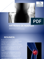 Artrosis de Rodilla