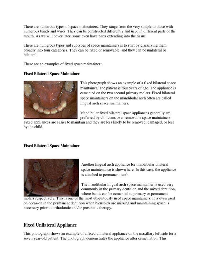 Fixed Space Maintainer PDF Dentistry Mouth