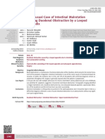 An Unusual Case of Intestinal Malrotation Causing Duodenal Obstruction by A Looped Appendix