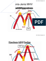 Jenis-Jenis MHV
