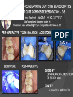 Department of Conservative Dentistry &endodontics Light Cure Composite Restoration - 36