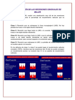 Clasificación de Las Recesiones Gingivales de Miller