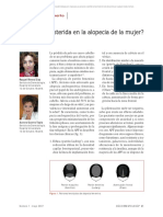 Finasteride en Alopecía Femenina PDF