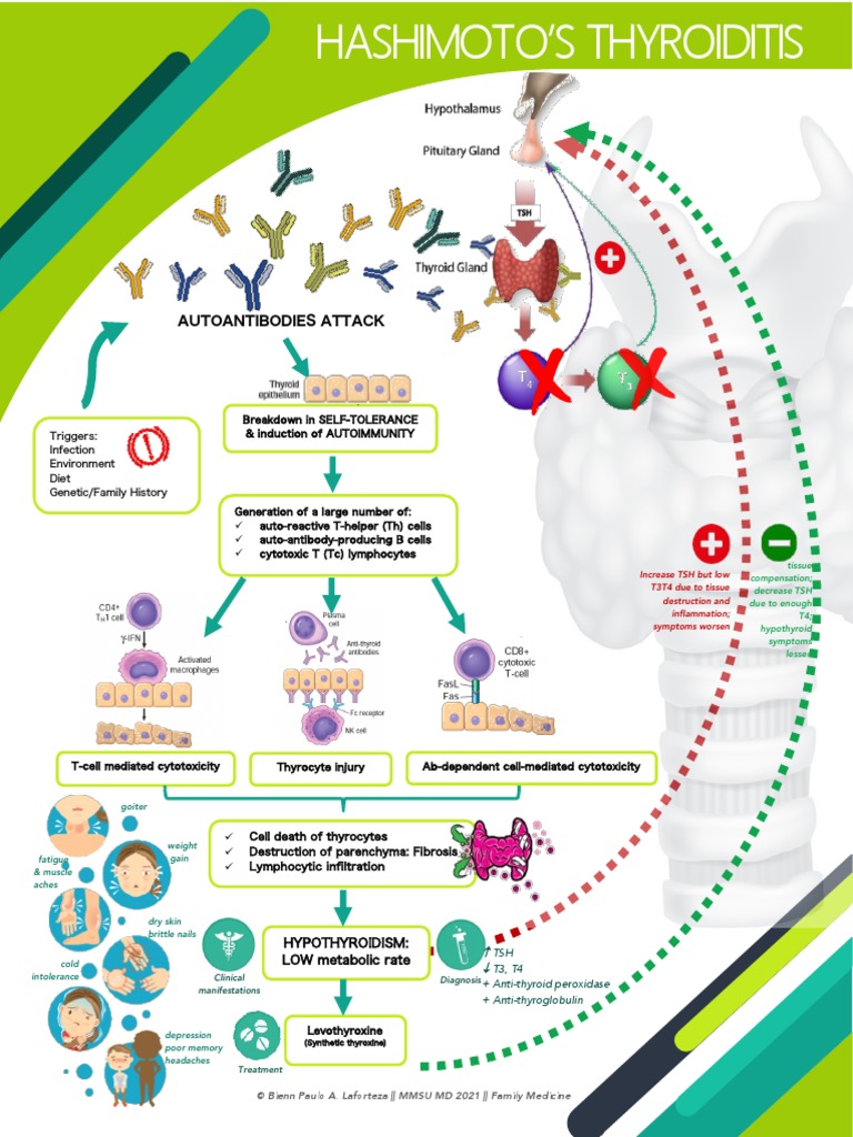 Hashimoto's Thyroiditis Infographic | PDF | Hypothyroidism | Endocrinology