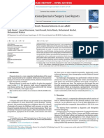 Unilateral Case Atresia Koana