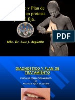 Diagnostico y Plan de Tratamiento en Protesis Fija