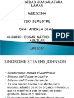 Sindrome Stevens Johnson 2