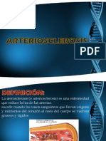 Arteriosclerosis T