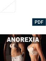Anorexia fases 