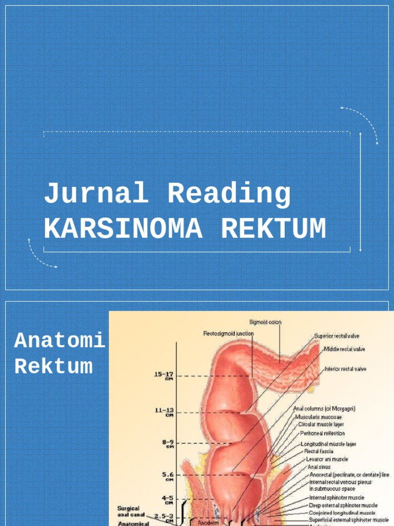 Kanker Rektum: Diagnosis dan Penatalaksanaan | PDF | Sains & Matematika