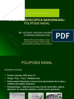 cirugiaendoscopicaenpoliposisnasal-130214143121-phpapp02