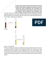 Platelet Rich Plasma