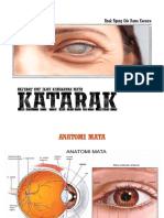 Katarak