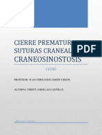 Cierre Prematuro de Suturas Craneales