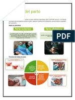 Trabajo de Parto Informe
