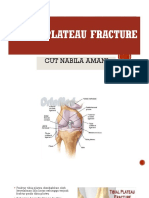 Tibial Plateau Fracture Treatment