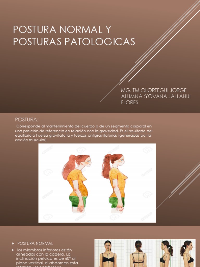 Postura Normal y Posturas Patologicas | PDF | La columna vertebral ...