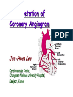 interpretation of coronary angiogram