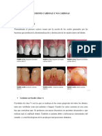 Lesiones dentales: cariosas y no cariosas