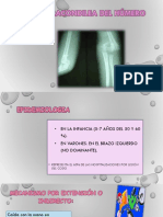 FX Supracondilea Del Húmero