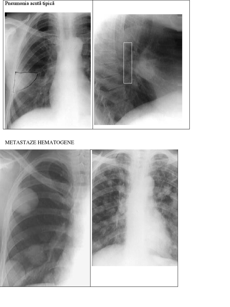 Respirator Radio | PDF