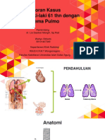 PULMONARY EDEMA